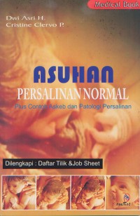 Asuhan Persalinan Normal; Plus Contoh Askeb dan PAtologi Persalinan