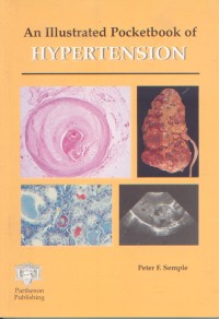 Image of An Illustrated Pocketbook of Hypertension