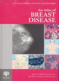 Image of The Encyclopedia of Visual Medicine Series An Atlas of Breast Disease