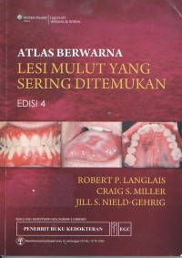 Image of Atlas Berwarna Lesi Mulut yang Sering ditemukan Edisi 4