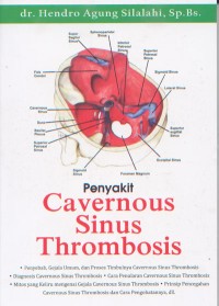 Image of Penyakit Cavernous Sinus Thrombosis
