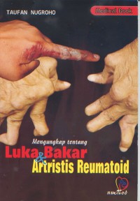 Image of Mengungkap tentang Luka Bakar dan Artristis Reumatoid