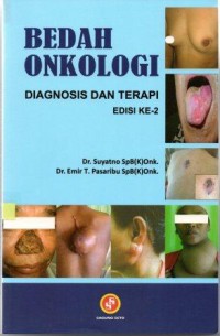 Bedah Onkologi: diagnosis dan terapi Edisi ke-2