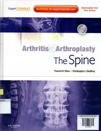 Image of Arthritis & Arthroplasty: the spine 1st Edition