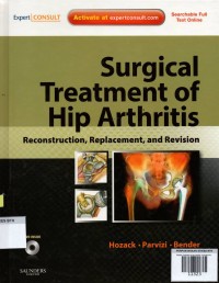 Surgical Treatment of Hip Arthritis: reconstruction, replacement, and revision 1st Edition