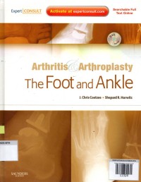 Arthritis & Arthroplasty: the foot and ankle