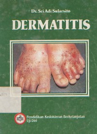 Image of Dermatitis