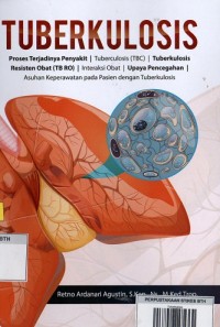 Image of Tuberkulosis